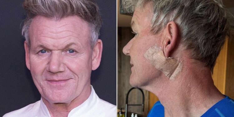 Gordon Ramsay kansere yakalandı