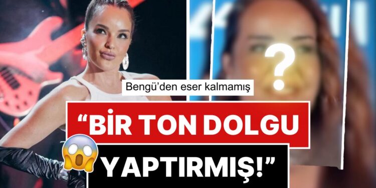 Hiç Estetik Yaptırmadığını İddia Eden Şarkıcı Bengü’nün Yüzündeki Büyük Değişim Hayrete Düşürdü!