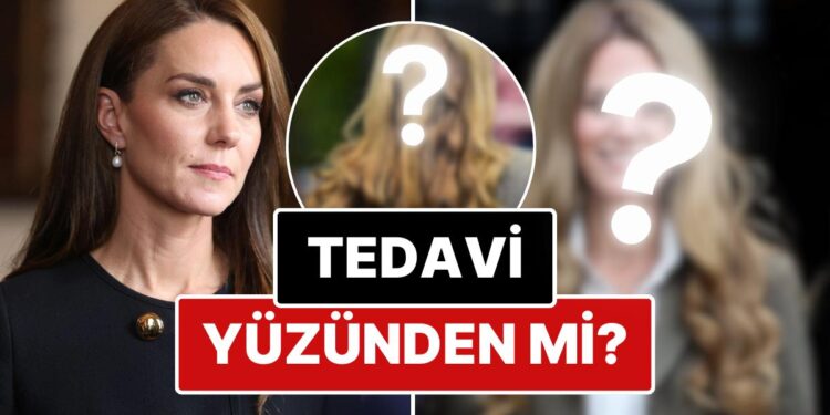 Kanser Teşhisi Konulmasının Ardından Ortadan Kaybolan Kate Middleton’ın Yeni Saçları Peruk İddialarını Doğurdu