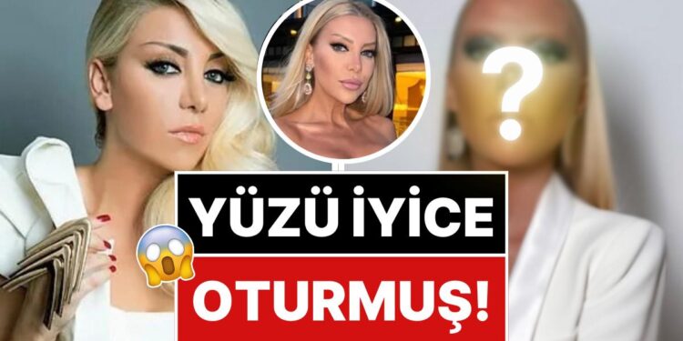 Son Hali Şoka Soktu: 9 Saatlik Operasyonla Kendini Baştan Yaratan Gülşah Saraçoğlu’nun Yüzü İyice Oturdu!