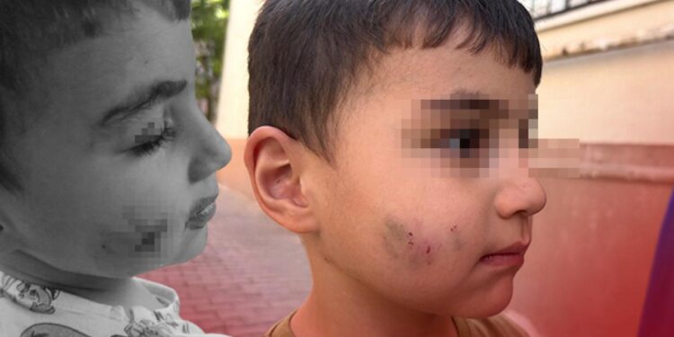 Uyurken dehşeti yaşadı: Lağım faresi ısıran çocuğa kuduz aşısı yapıldı!