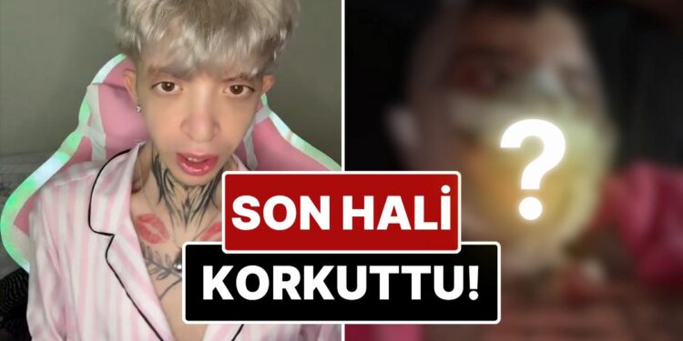 Eleştiriler Sonrası Yüzüne Birçok Estetik İşlem Yaptıran ‘Tablet Reis’in Son Hali Görenleri Korkuttu!