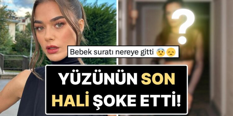 “Eski Doğallığı Nereye Gitti?” Paris Moda Haftası’na Katılan Bensu Soral’ın Yüzünün Son Hali Dikkat Çekti