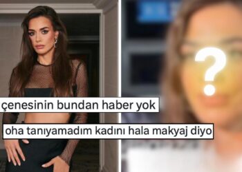 Estetik İddialarını Yalanlayan Bensu Soral’ın Kameraya Yansıyan Yüz Hatları İnandırıcılığını Sorgulattı!