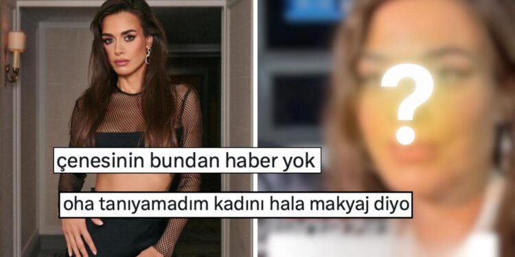 Estetik İddialarını Yalanlayan Bensu Soral’ın Kameraya Yansıyan Yüz Hatları İnandırıcılığını Sorgulattı!