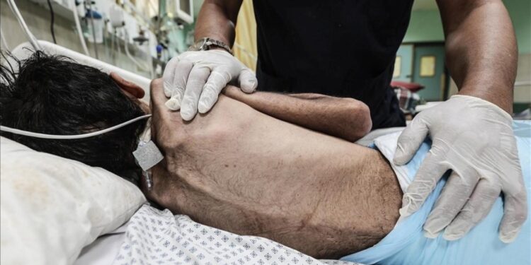 Gazze’de açlıktan ölenlerin sayısı 404’e yükseldi