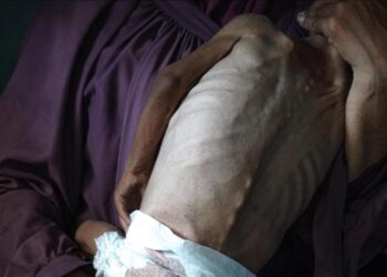 Gazze’de son 1 günde 1’i çocuk 6 kişi daha açlıktan şehit oldu
