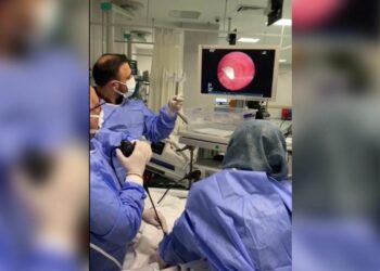 Hastanın akciğerine kaçan sarımsak operasyonla çıkarıldı