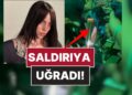 Kolundan Tutup Bariyere Çekti: Billie Eilish, Konserde Hayranının Saldırısına Uğradı!