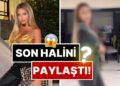 Son Halini Paylaştı: Cinsiyet Geçiş Sürecini Tamamlayan Mika Raun Bu Sefer de Poposunu Yaptırdı!