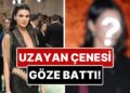 Uzayan Çenesi Göze Battı: Kendall Jenner’ın Yüzünün Son Hali Estetik İddialarını Gündeme Taşıdı!