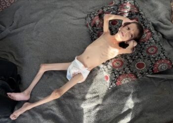 10 yaşındaki Gazzeli Nafız 4 aylık bebeğe dönüştü: Annesi taşımaya bile korkuyor