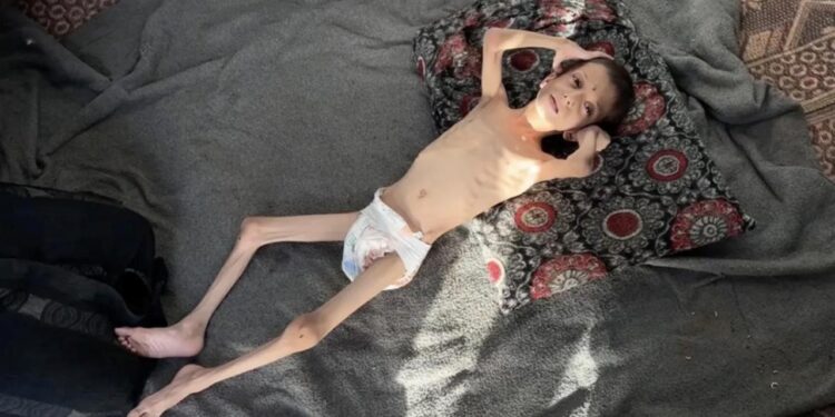 10 yaşındaki Gazzeli Nafız 4 aylık bebeğe dönüştü: Annesi taşımaya bile korkuyor