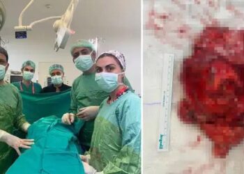 2.5 milyonda bir görülüyor, tam 1,1 kg!