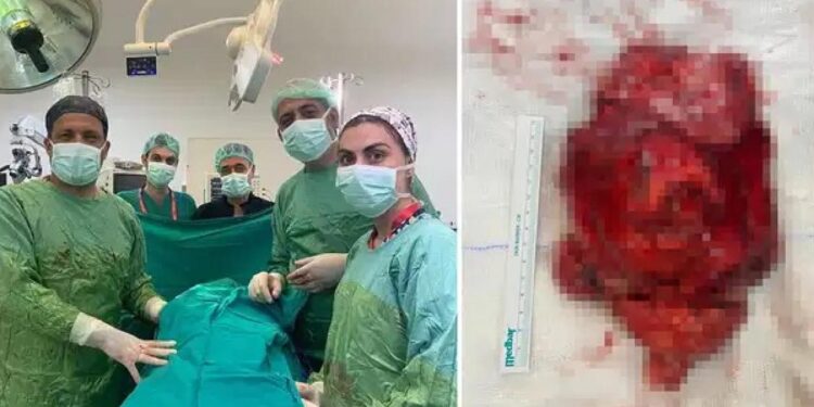 2.5 milyonda bir görülüyor, tam 1,1 kg!