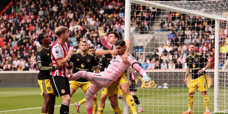 Altay Bayındırlı Manchester United tanınmaz halde!