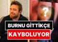 Artık Bitti Sanıyorduk: Burnuyla Derdi Bitmeyen Murat Dalkılıç’ın 12. Kez Ameliyat Olduğu Ortaya Çıktı!