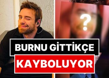 Artık Bitti Sanıyorduk: Burnuyla Derdi Bitmeyen Murat Dalkılıç’ın 12. Kez Ameliyat Olduğu Ortaya Çıktı!