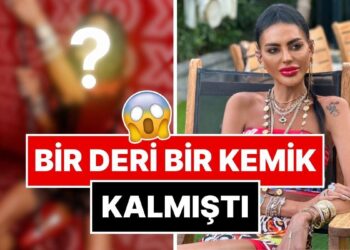 Aşırı Zayıflığı Yüzünden Eleştirilen Süreyya Yalçın, Son Halini Yorumlara Kapatıp Paylaştı!