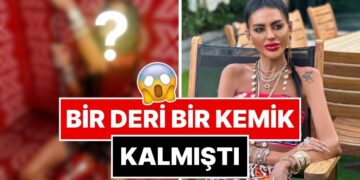 Aşırı Zayıflığı Yüzünden Eleştirilen Süreyya Yalçın, Son Halini Yorumlara Kapatıp Paylaştı!