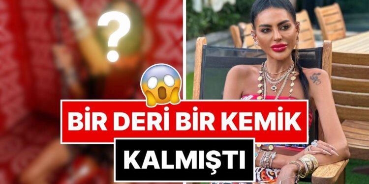 Aşırı Zayıflığı Yüzünden Eleştirilen Süreyya Yalçın, Son Halini Yorumlara Kapatıp Paylaştı!