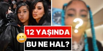 Dişlerini Siyah Metalle Kaplatan 12 Yaşındaki North West’in Son Hali Akıllara Durgunluk Verdi!