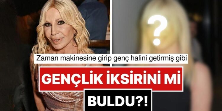 Dolgularını Eritmişti: 70 Yaşındaki Donatella Versace’nin Son Hali Aklımızı İzanımızı Şaşırttı!