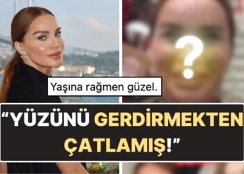 Ebru Şallı’nın Filtresiz ve Photoshopsuz Hali Ortaya Çıktı: Yüzünün Son Hali Tartışma Yarattı!