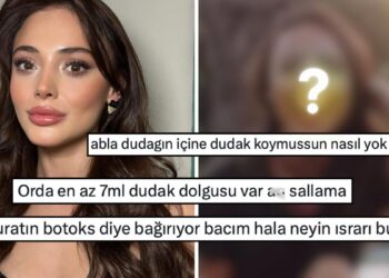 Eski Fotoğrafları Yeniden Dolaşıma Girdi: Estetik İşlemleri Yalanlamakta Israrcı Olan Rabia Soytürk Dile Düştü