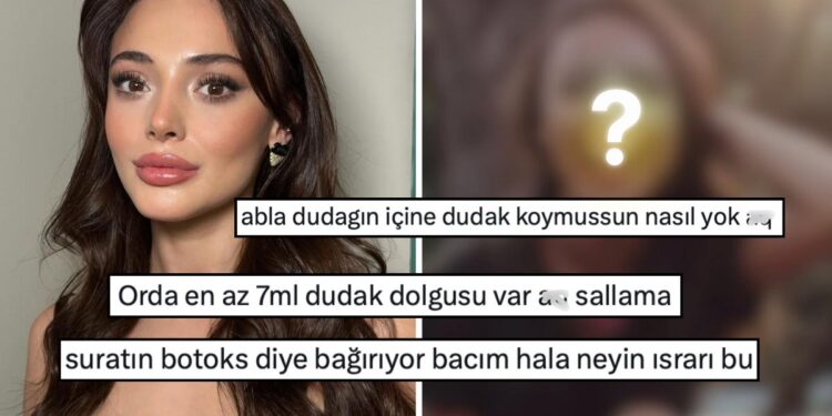 Eski Fotoğrafları Yeniden Dolaşıma Girdi: Estetik İşlemleri Yalanlamakta Israrcı Olan Rabia Soytürk Dile Düştü