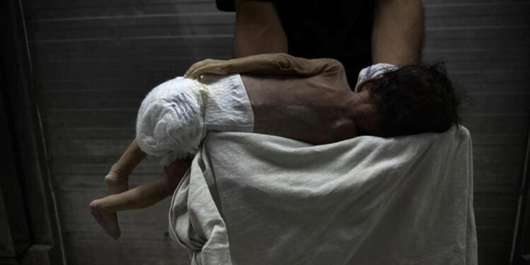 Gazze’de insani kriz derinleşiyor! Kıtlık dönülmez bir hal aldı! Ölümler son sürat!