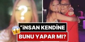 “İnsan Kendine Bunu Yapar mı?” Mali’nin Canı Sıkılan Kızı Yasmin Erbil’den Radikal İmaj Değişikliği!
