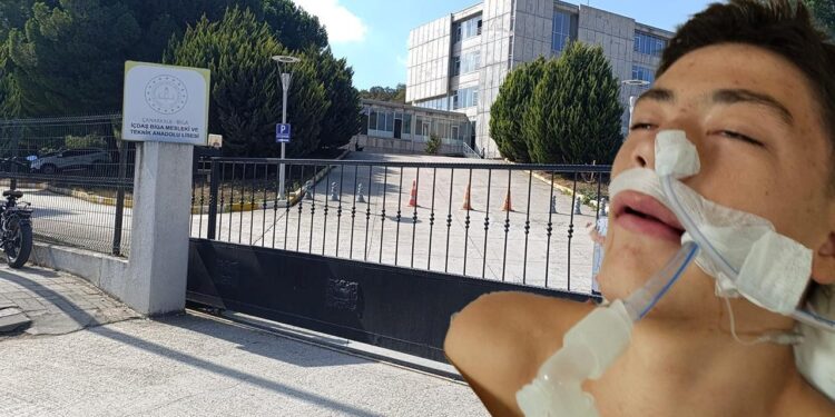 Lisede korkunç olay: Ayağına basan arkadaşını komalık etti