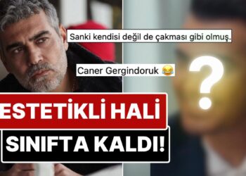 Saçlarını Boyatıp Dişlerini Yaptıran Caner Cindoruk’un Estetikli Son Halini Görenler Tanımakta Zorlandı!