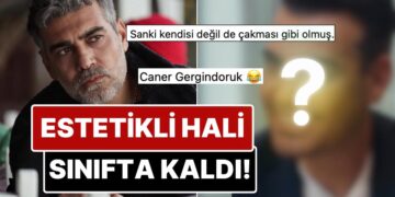 Saçlarını Boyatıp Dişlerini Yaptıran Caner Cindoruk’un Estetikli Son Halini Görenler Tanımakta Zorlandı!