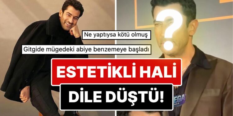 Son Haliyle Dikkat Çeken Kenan İmirzalıoğlu’nun Yüzüne Yaptırdığı Estetik İşlemler Göze Battı!