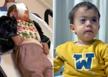 Baba Acı Gerçeği Duyurdu Çocuğun Gözünü Torpil Aldı