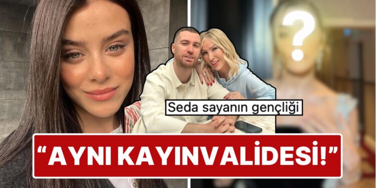 Yaptırdığı Estetik İşlemlerle Dile Düşen İlayda Alişan’ın Yüzünün Son Hali Kaynanası Seda Sayan’a Benzetildi!