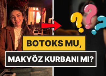 Yüz Hatları Dikkat Çekti: Ayça Ayşin Turan’ın Son Pozları Botoks İddialarına Neden Oldu!