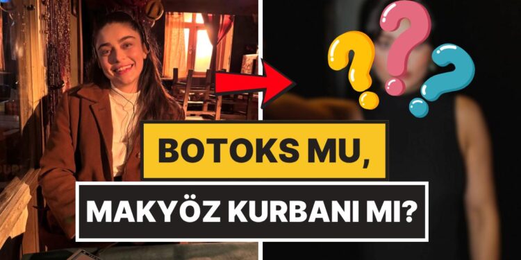 Yüz Hatları Dikkat Çekti: Ayça Ayşin Turan’ın Son Pozları Botoks İddialarına Neden Oldu!