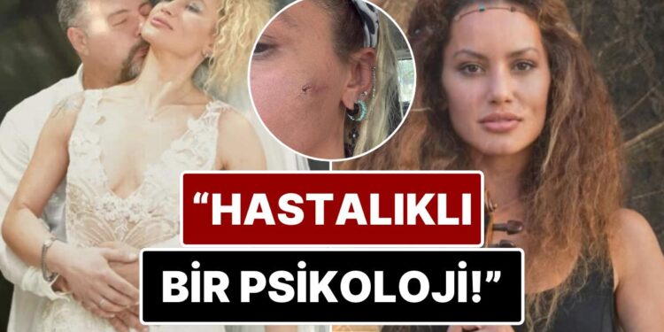 7 Ay Önce Evlendiği Mustafa Semih Demirci’den Şiddet Gördüğünü İddia Eden Yıldız Asyalı Yaşadıklarını Anlattı