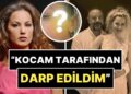 7 Ay Önce Evlenen Yıldız Asyalı, Eşi Tarafından Darp Edildiğini Duyurdu ve Fotoğraflarını Paylaştı!