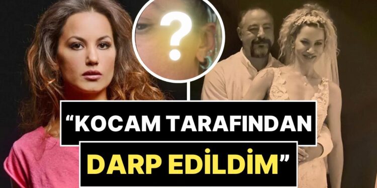 7 Ay Önce Evlenen Yıldız Asyalı, Eşi Tarafından Darp Edildiğini Duyurdu ve Fotoğraflarını Paylaştı!