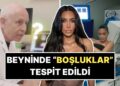 Beyninde ‘Boşluklar’ Tespit Edilen Kim Kardashian, Sağlık Problemini Öğrenince Şoka Girdi!