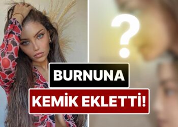 Cinsiyet Geçiş Ameliyatıyla Konuşulan Beren Güney Estetik Operasyonla Burnuna Kemer Ekletti!