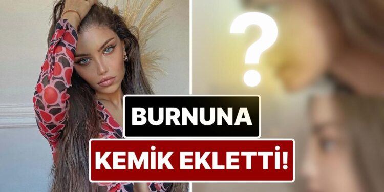 Cinsiyet Geçiş Ameliyatıyla Konuşulan Beren Güney Estetik Operasyonla Burnuna Kemer Ekletti!
