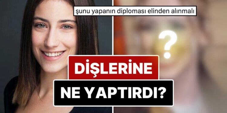 Diş Estetiğinin Ardından Dillere Büyük Düşen Hazal Kaya’nın Yaptırdığı İşlemleri ve Değişimini İnceliyoruz!