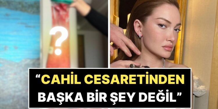 Estetik Mağduru Danla Bilic, Beşinci Ameliyata Vücudundan Çıkarılan Dolgu Yığınıyla Şoke Etti!