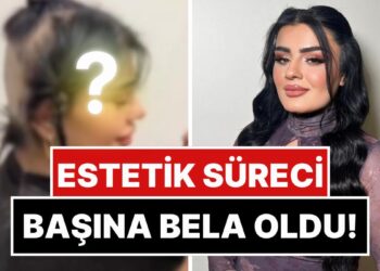 Estetik Sürecinde İçtiği İlaçlar Yüzünden Saçları Dökülen Hülya Mizgin, Son Halini Paylaştı!