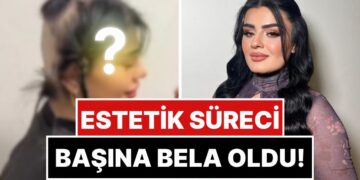 Estetik Sürecinde İçtiği İlaçlar Yüzünden Saçları Dökülen Hülya Mizgin, Son Halini Paylaştı!